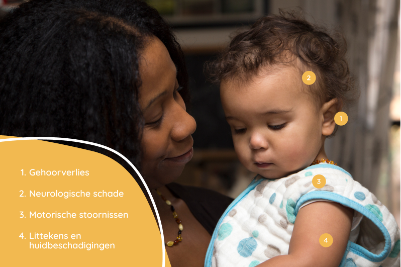 Moeder met kind waarop symptomen van meningitis door meningokokken op het lichaam aangeduid zijn Moeder met kind waarop symptomen van meningitis door meningokokken op het lichaam aangeduid zijn